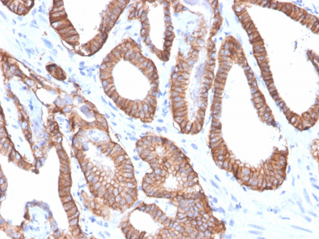Ep-CAM/CD326 (Extracellular Domain) (Epithelial Marker) Antibody in Immunohistochemistry (Paraffin) (IHC (P))