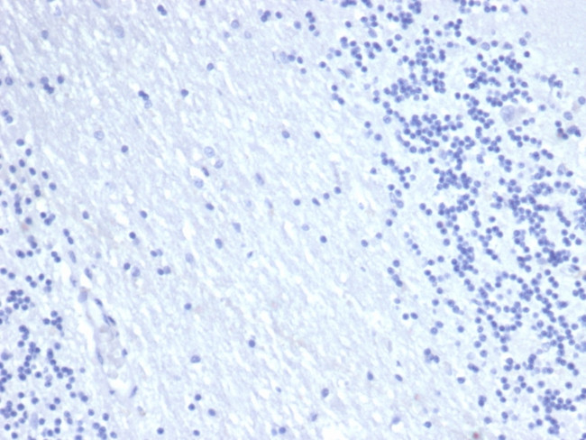EpCAM/CD326 Antibody in Immunohistochemistry (Paraffin) (IHC (P))