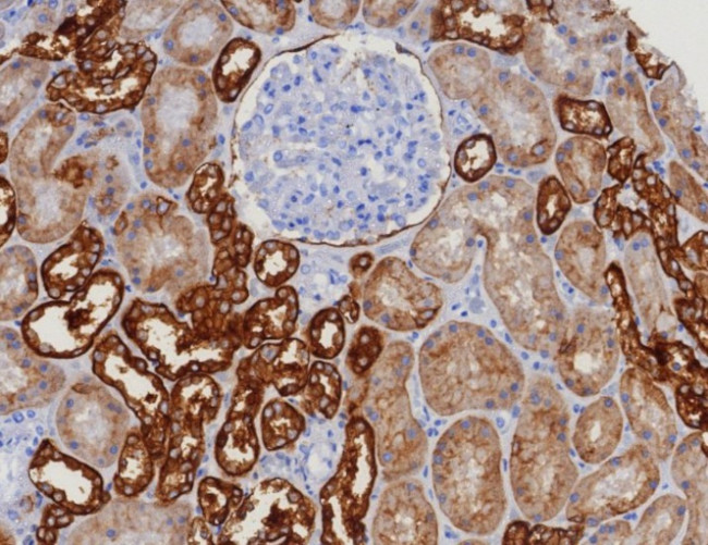 EpCAM/CD326 (Epithelial Marker) Antibody in Immunohistochemistry (Paraffin) (IHC (P))
