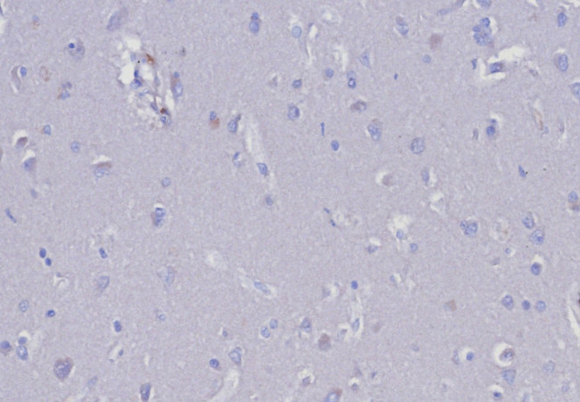 EpCAM/CD326 (Epithelial Marker) Antibody in Immunohistochemistry (Paraffin) (IHC (P))