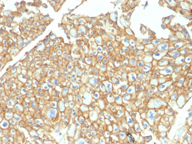 EpCAM/CD326 (Epithelial Marker) Antibody in Immunohistochemistry (Paraffin) (IHC (P))