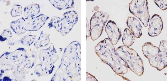 LRP8 Antibody in Immunohistochemistry (Paraffin) (IHC (P))
