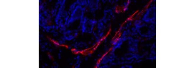 LYVE1 Antibody in Immunohistochemistry (Frozen) (IHC (F))