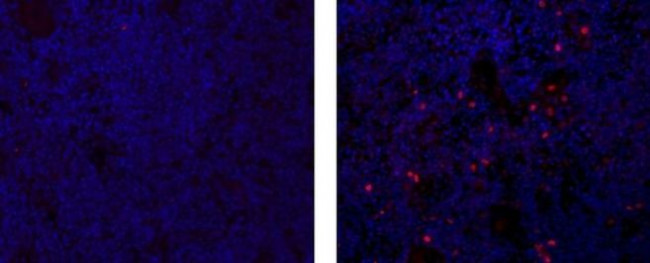 AIRE Antibody in Immunohistochemistry (Paraffin) (IHC (P))
