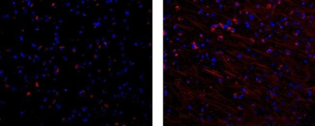 MAP2 Antibody in Immunohistochemistry (Paraffin) (IHC (P))