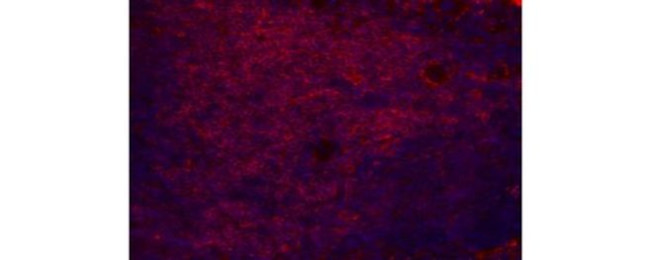 CD4 Antibody in Immunohistochemistry (Paraffin) (IHC (P))