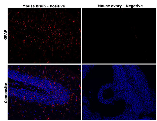 GFAP Antibody in Immunohistochemistry (Paraffin) (IHC (P))