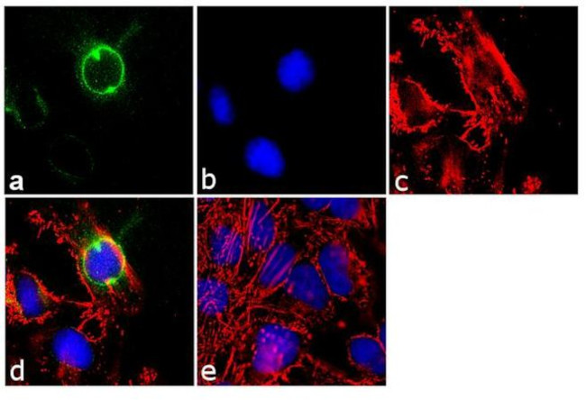 CEP170 Antibody in Immunocytochemistry (ICC/IF)