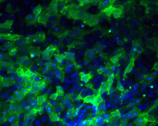 SSEA3 Antibody in Immunocytochemistry (ICC/IF)