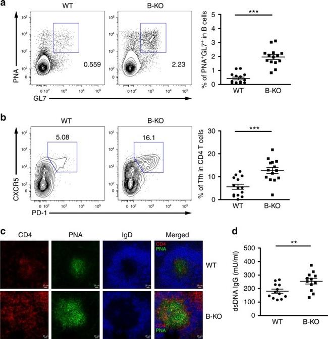 Mouse IgD Antibody in Immunohistochemistry (IHC)