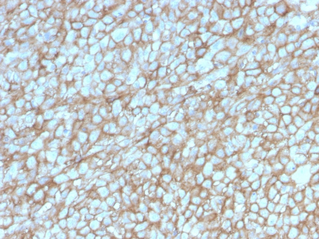 MCAM (Melanoma Cell Adhesion Molecule)/MUC18/CD146 Antibody in Immunohistochemistry (Paraffin) (IHC (P))