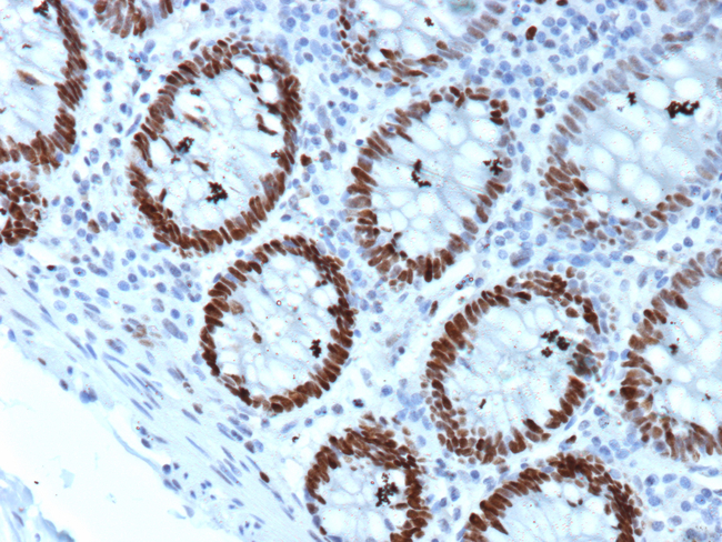 MCM4 (Pan Cancer Marker) Antibody in Immunohistochemistry (Paraffin) (IHC (P))
