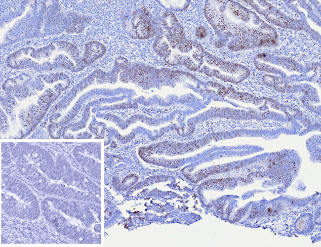 MCM4 (Pan Cancer Marker) Antibody in Immunohistochemistry (Paraffin) (IHC (P))