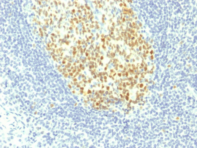 MCM7 (Proliferation Marker) Antibody in Immunohistochemistry (Paraffin) (IHC (P))