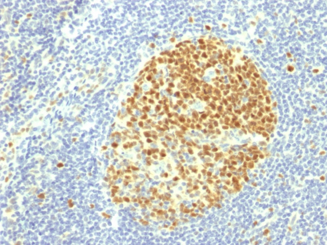 MCM7 (Proliferation Marker) Antibody in Immunohistochemistry (Paraffin) (IHC (P))