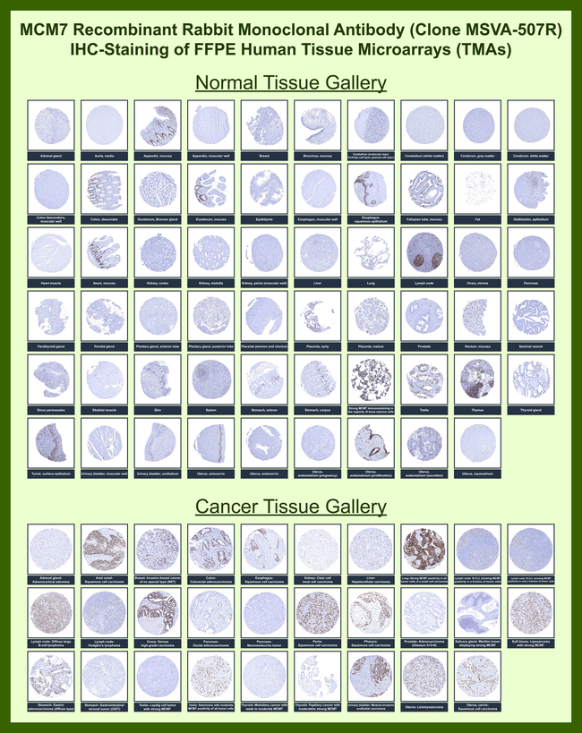 MCM7 (Proliferation Marker) Antibody in Immunohistochemistry (Paraffin) (IHC (P))