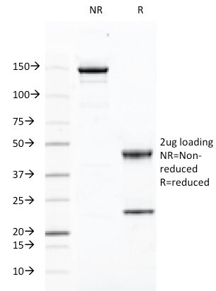 CD46 (Membrane Cofactor Protein) Antibody in SDS-PAGE (SDS-PAGE)