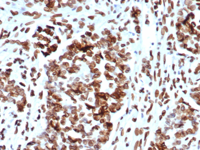 MDM2 Antibody in Immunohistochemistry (Paraffin) (IHC (P))