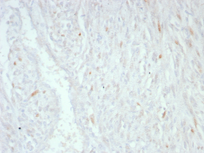 MDM2 Antibody in Immunohistochemistry (Paraffin) (IHC (P))