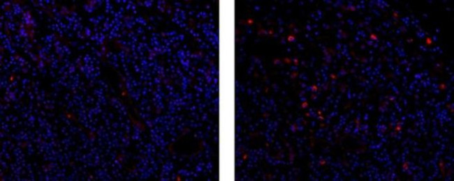 Rat IgG2b Secondary Antibody in Immunohistochemistry (Paraffin) (IHC (P))