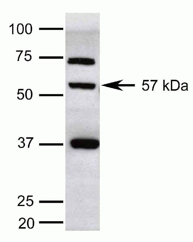 KLF5 Antibody in Western Blot (WB)