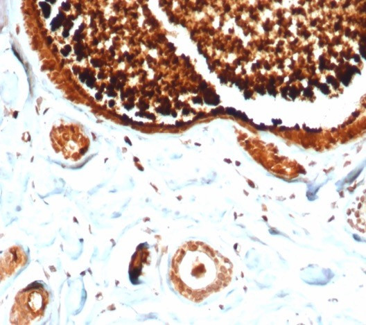 Mammaglobin (SCGB2A2) (Breast Cancer Marker) Antibody in Immunohistochemistry (Paraffin) (IHC (P))