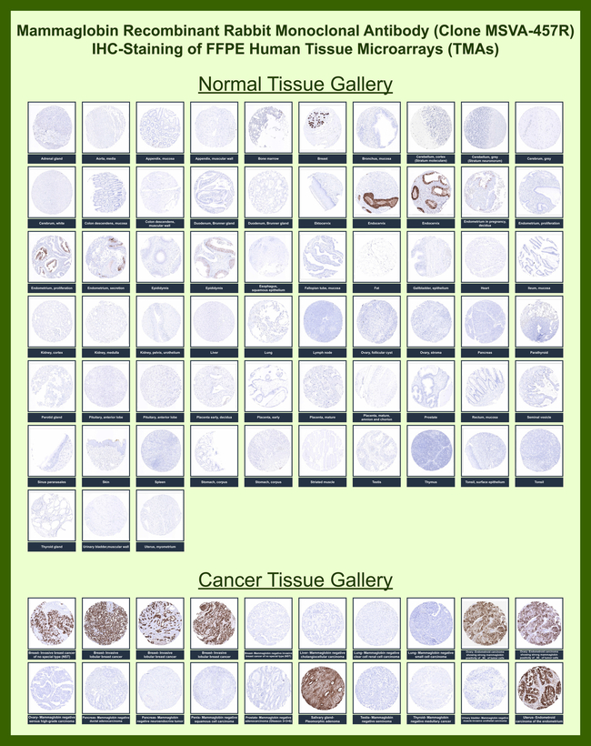 Mammaglobin (SCGB2A2) (Breast Cancer Marker) Antibody in Immunohistochemistry (Paraffin) (IHC (P))