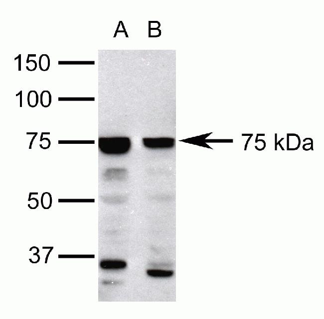 FOXP1 Antibody in Western Blot (WB)