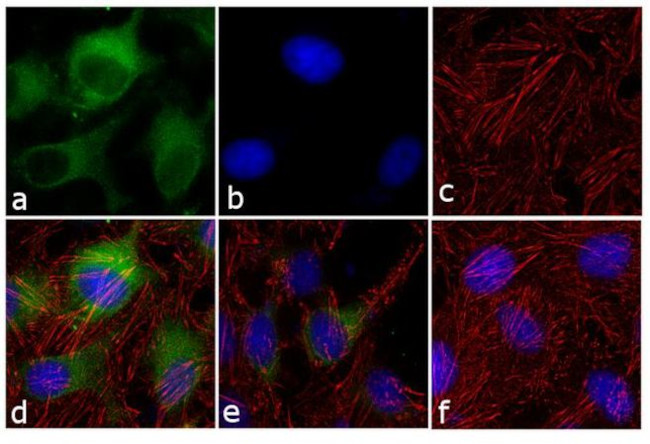 NDRG1 Antibody in Immunocytochemistry (ICC/IF)