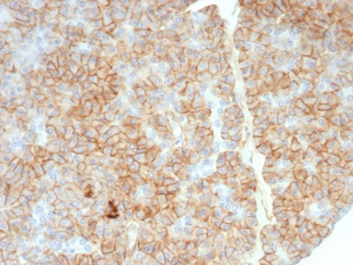 CD99/MIC2 (Ewing's Sarcoma Marker) Antibody in Immunohistochemistry (Paraffin) (IHC (P))