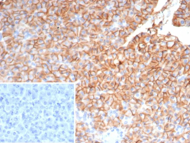 CD99/MIC2 (Ewing's Sarcoma Marker) Antibody in Immunohistochemistry (Paraffin) (IHC (P))
