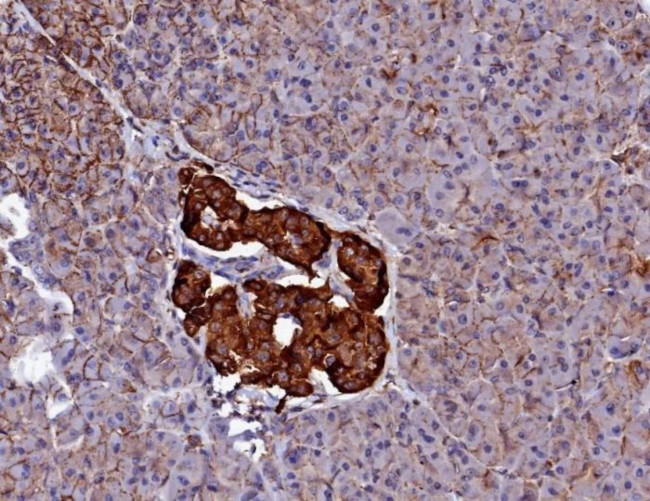 CD99/MIC2 (Ewing's Sarcoma Marker) Antibody in Immunohistochemistry (Paraffin) (IHC (P))