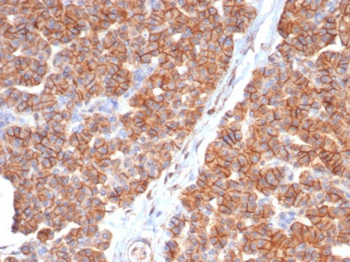 CD99/MIC2 (Ewing's Sarcoma Marker) Antibody in Immunohistochemistry (Paraffin) (IHC (P))