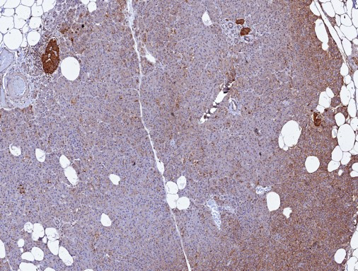 CD99/MIC2 (Ewing's Sarcoma Marker) Antibody in Immunohistochemistry (Paraffin) (IHC (P))