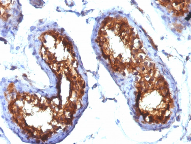 CD99/MIC2 Antibody in Immunohistochemistry (Paraffin) (IHC (P))