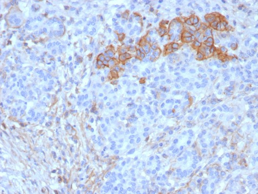 CD99/MIC2 (Ewing's Sarcoma Marker) Antibody in Immunohistochemistry (Paraffin) (IHC (P))