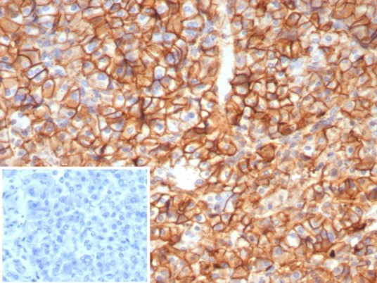 CD99/MIC2 (Ewing's Sarcoma Marker) Antibody in Immunohistochemistry (Paraffin) (IHC (P))