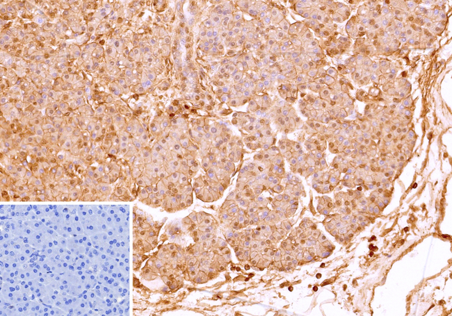 CD99/MIC2 (Ewing's Sarcoma Marker) Antibody in Immunohistochemistry (Paraffin) (IHC (P))