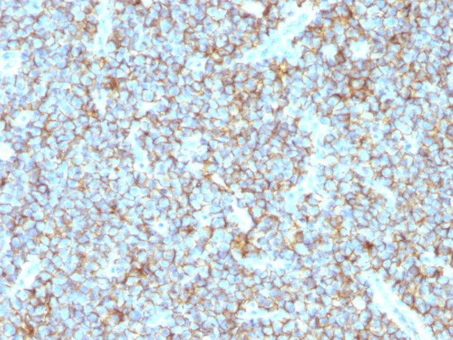 CD99/MIC2 (Ewing's Sarcoma Marker) Antibody in Immunohistochemistry (Paraffin) (IHC (P))