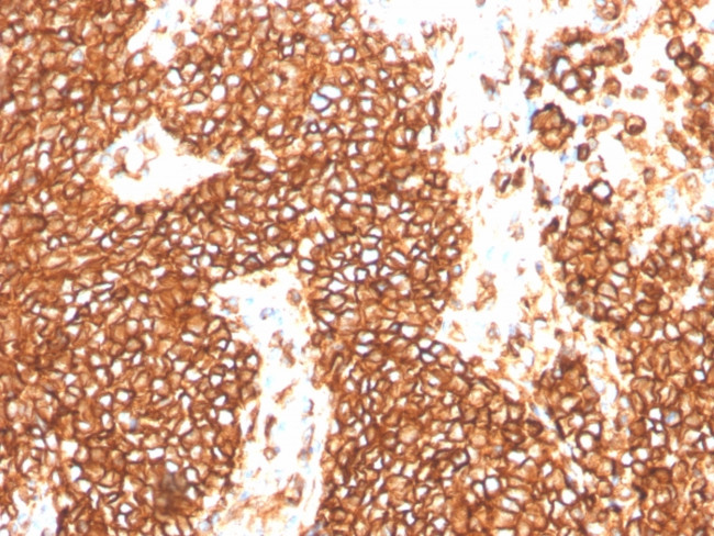CD99/MIC2 Antibody in Immunohistochemistry (Paraffin) (IHC (P))