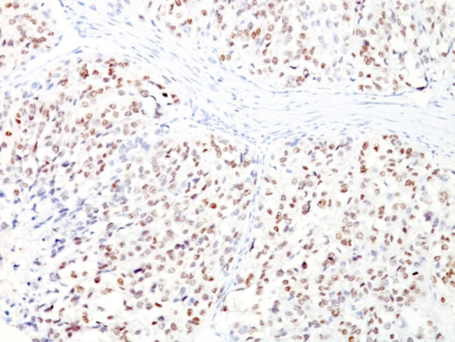 Microphthalmia Transcription Factor (MITF) Antibody in Immunohistochemistry (Paraffin) (IHC (P))