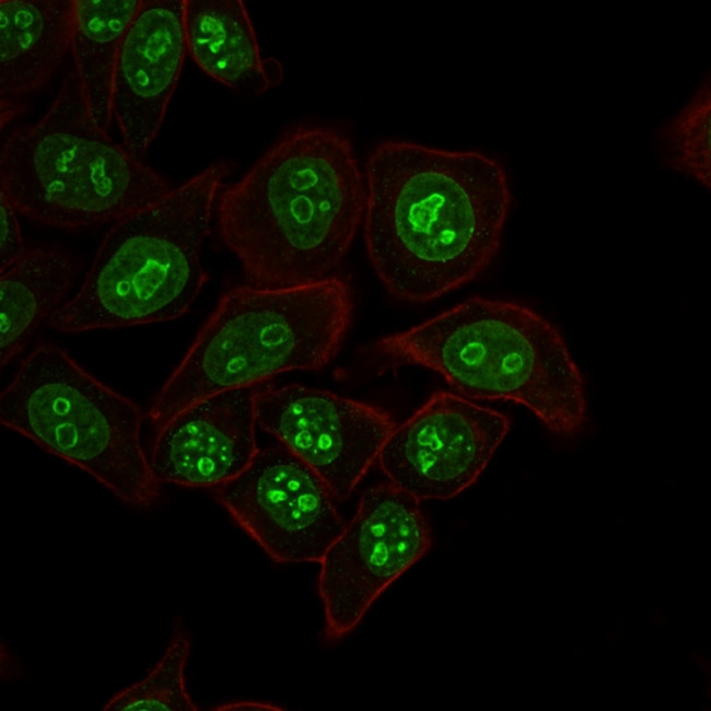 Ki-67 Antibody in Immunocytochemistry (ICC/IF)