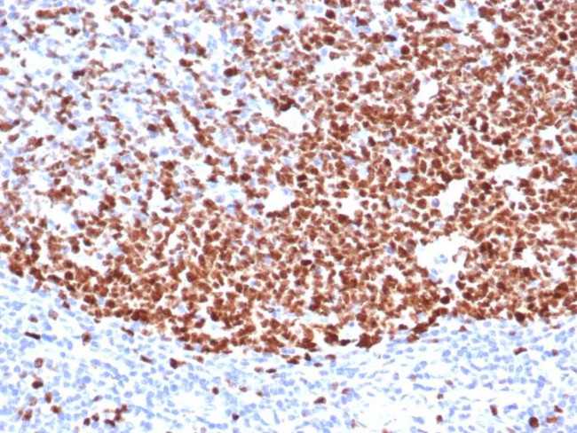 Ki-67 (Proliferating Cell Marker) Antibody in Immunohistochemistry (Paraffin) (IHC (P))