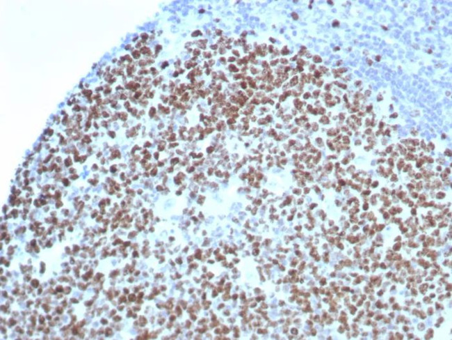 Ki-67 (Proliferating Cell Marker) Antibody in Immunohistochemistry (Paraffin) (IHC (P))
