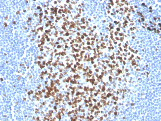 Ki-67 (Proliferating Cell Marker) Antibody in Immunohistochemistry (Paraffin) (IHC (P))