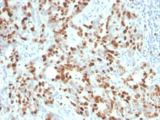 Ki-67 Antibody in Immunohistochemistry (Paraffin) (IHC (P))
