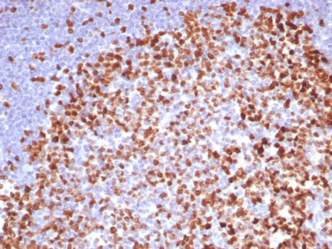 Ki-67 (Proliferating Cell Marker) Antibody in Immunohistochemistry (Paraffin) (IHC (P))