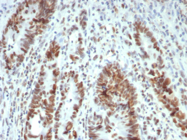 MLH1 (MutL Homolog 1) (Center)/HNPCC Antibody in Immunohistochemistry (Paraffin) (IHC (P))