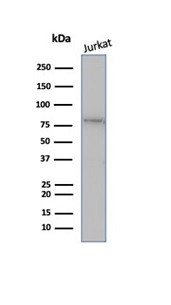 MLH1 (MutL Homolog 1) Antibody in Western Blot (WB)