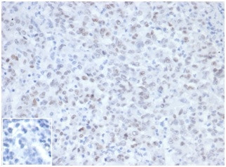 MLH1 (MutL Homolog 1)/HNPCC Antibody in Immunohistochemistry (Paraffin) (IHC (P))